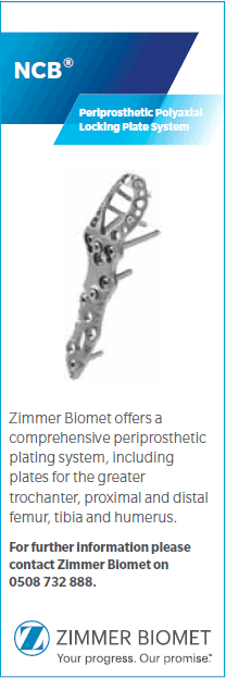 NCB - Periprosthetic Locking plate system